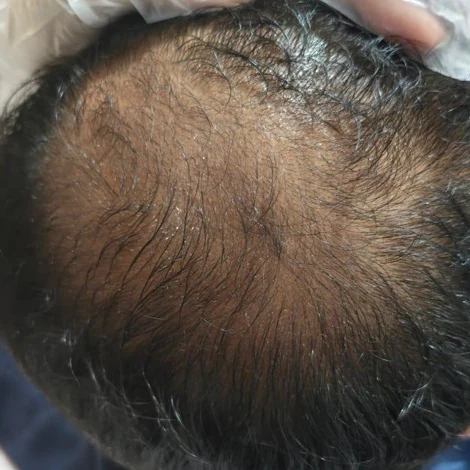 Before treatment